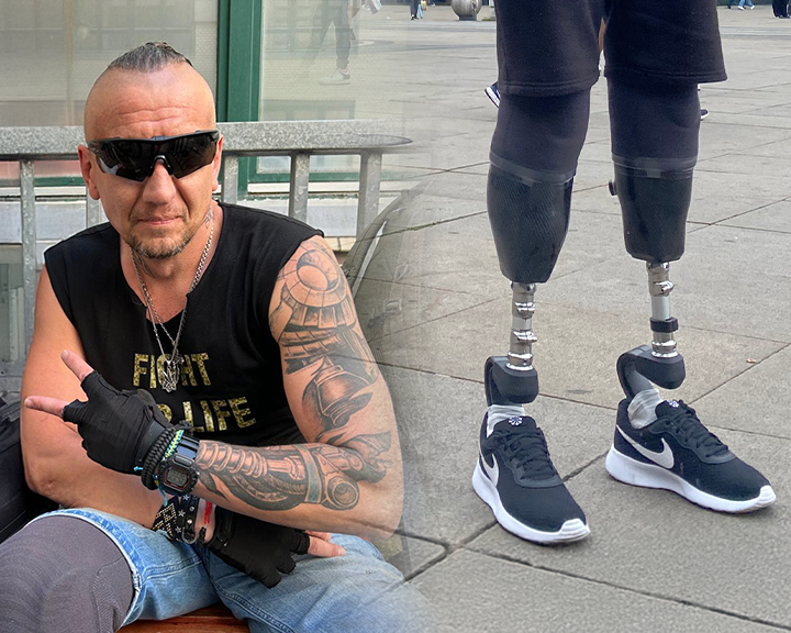 Bild von ukrainischem Mann und seinen Beinprotesen